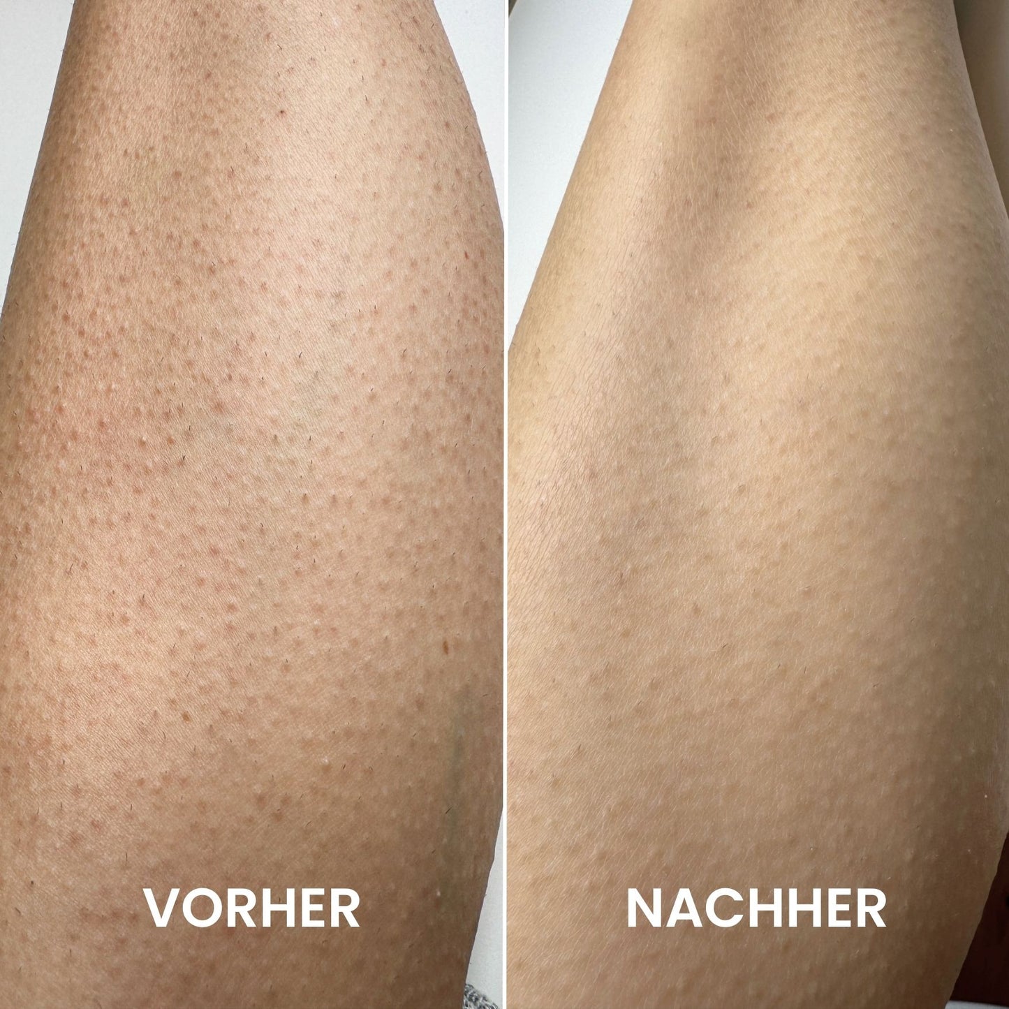 Summer Peeling Set