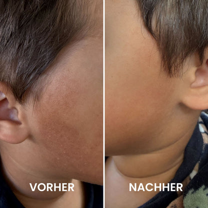 Kids & Teens Reibeisenhaut Set