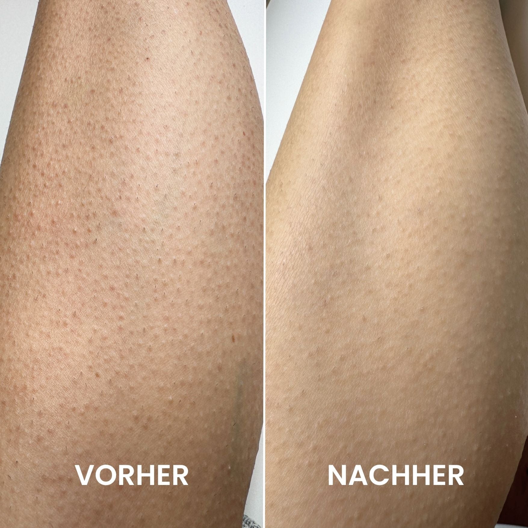 peeling handschuh test Peeling Handschuh – Tanera Skin