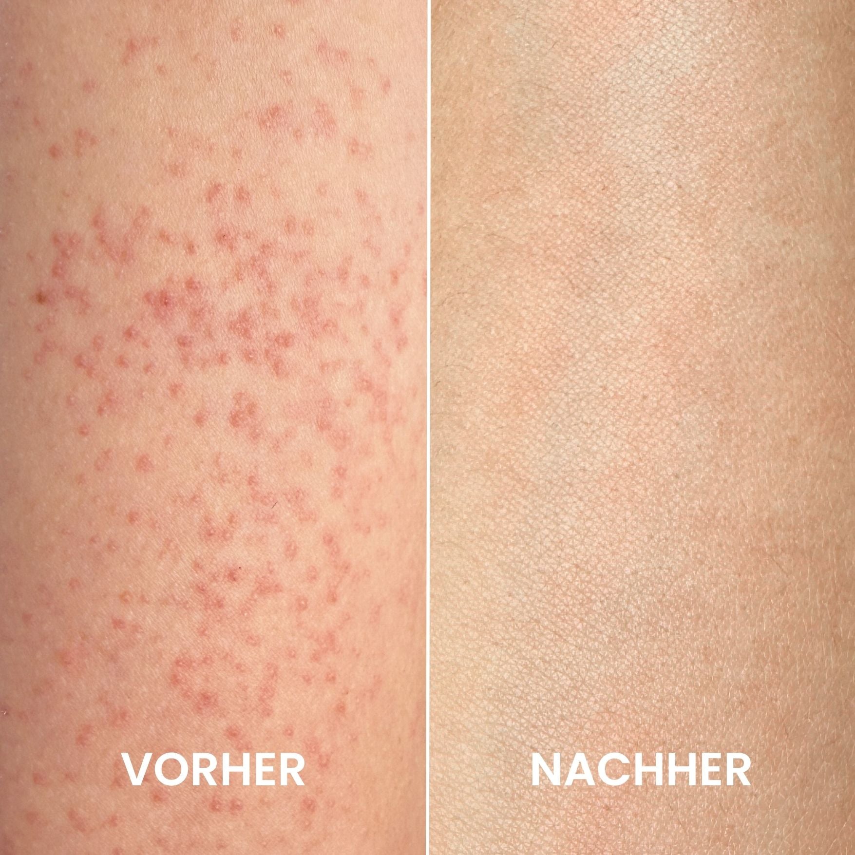 haut peeling handschuh Peeling Handschuh – Tanera Skin