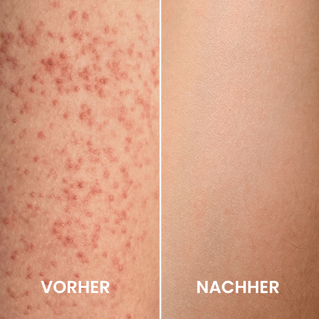 Jahresvorrat Peeling Handschuhe