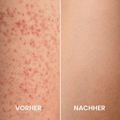 Jahresvorrat Peeling Handschuhe