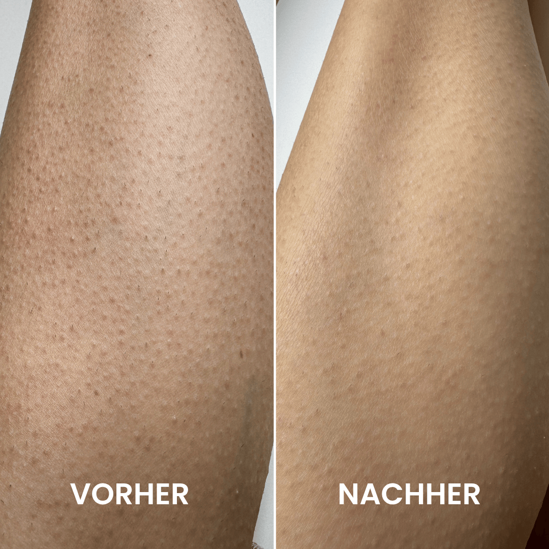 Jahresvorrat Peeling Handschuhe