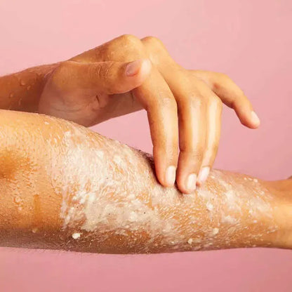 Keratosis Pilaris Body Scrub